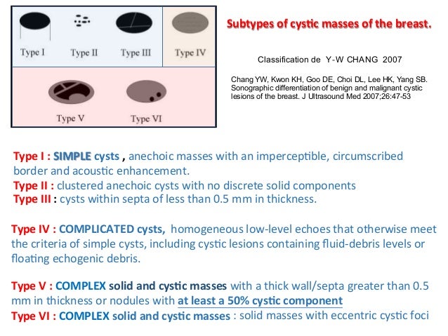 solid breast cyst San diego orgys